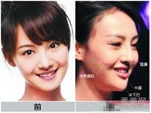 福州整形爆料事件真相视频,揭秘真相与争议 第3张 福州整形爆料事件真相视频,揭秘真相与争议 第3张